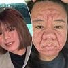 Woman, 28, reveals how pregnancy hormones made her face completely unrecognisable and 'like an old person'