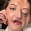 Woman, 33, killed by cancer that 'stole' half her face after doctors dismissed it for common winter problem