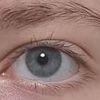 I posted this photo of my eye on Reddit and strangers demanded I see a doctor urgently - they saved my life