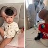 Jongetje (3) met bijnaam Mickey Mouse transformeert door operatie voor zeldzame aandoening