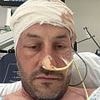 I thought I had a common hangover symptom - it was actually TWO deadly brain tumours