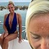 I paid £25 for a quick fix to get a better tan - but I've been left with irreversible damage on my face