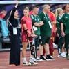 Fußball-EM: Frankreich-Spiel als „Gradmesser“ für Fußballerinnen und DFB