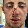 After losing my nine-year-old daughter to epilepsy, my son nearly died when he was beaten up in savage street attack - but the case has been DROPPED by CPS