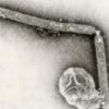 The US hasn't seen a human bird flu case in 3 months. Experts are wondering why