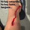 Athletic Bilbao star shows off horror gash as wild Lindelof challenge leaves him needing stitches after Man Utd clash