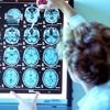 China meldt kort na Musk ook stap in “hersenimplantatenrace”