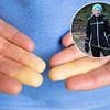 Is aircon in current heatwave causing you agony? You may be one of ten million Britons who suffer from painful condition triggered by colder temperatures