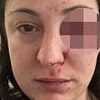 Tesco shopper who was beaten in the street after she stood up to shoplifters reveals how her ordeal has ruined her life