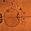 Pollution, stress, infections… Quelles sont les causes du déclin de la fertilité dans le monde ?