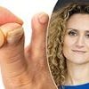 My toenails have gone hard, crusty and frighteningly yellow. Is there ANYTHING I can do? DR ELLIE has the most ingenious solution