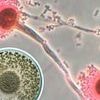 Deadly fungus that 'eats you from the inside out' invades US: 'Hundreds of thousands of lives at risk'