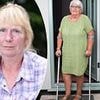 Faulty NHS knee implants left thousands in agony and unable to work... now experts reveal a new shocking twist in scandal and the other implants that face safety questions