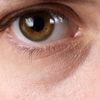 Mais pourquoi a-t-on des cernes lorsqu’on est fatigué ?