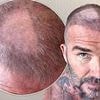 David Beckham is left with an unmissable bald patch on his head after DIY buzz-cut goes horribly wrong - and even Victoria admits it 'looks terrible'