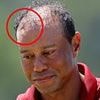 Plastic surgeon reveals the rumored surgery Tiger Woods had that has failed TWICE