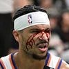 Knicks star Josh Hart gushes blood onto court in gruesome NBA playoff injury: 'Might need a transfusion'