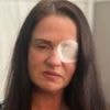 Woman left fighting for life as fake Botox beautician apologises