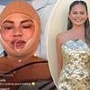 Chrissy Teigen, 39, sparks concern in shocking bandaged face photo