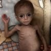 “Alsof ze nooit vrede zal kennen”: het verhaal achter baby Siwar, symbool van de honger in Gaza