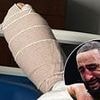 Belal Muhammad reveals how he 'almost had foot AMPUTATED' six months ago, as he lifts lid on gruesome injury ahead of UFC 315 title showdown