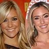 Kristin Cavallari's changing face: Plastic surgery expert weighs in after star bashed Botox