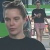 Helen Flanagan displays her painful-looking black eyes as she fills up her £66,000 Audi with petrol after undergoing £400 skin injections