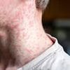 Vaccine shake-up: Health chiefs unveil major change to jab schedule amid concern about surge in child-killing infection
