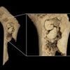 Un "banquet cannibale" vieux de quelque 6 000 ans découvert en Espagne