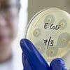Surge in infection linked to colon cancer sparks health alert - six dead, almost 400 hospitalised