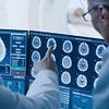 Scientists unlock the dementia code - groundbreaking research uncovers four 'early warning patterns' that may help prevent disease before it strikes