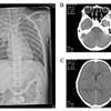 Eight-year-old suffers harrowing death from virus that's touched everyone's lives - she 'frothed at the mouth' after it spread to her brain