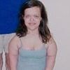 Teen who had controversial surgery to grow 13 inches reveals what she looks like now