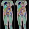 Biggest human imaging study scans 100,000th person