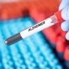 Les États-Unis approuvent le premier test sanguin de dépistage d’Alzheimer