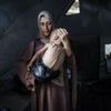 The story behind the photograph of a starving Gaza baby
