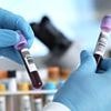 Now free on the NHS: Blood test that can pick up 12 types of cancer