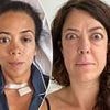 The shocking rise of bulging eyes in women over 40 - as doctors reveal the very common symptoms thousands can't afford to ignore