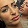 Chantelle Houghton shows off dramatic new look after 'liquid facelift' amid her five-stone weight loss