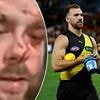 Footy star Noah Balta learns his fate for vicious assault that could have killed his victim - as judge's ruling will leave his AFL club furious