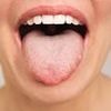 Why does my tongue keep tingling? It could be harmless. But it could also be lethal. Doctors reveal the subtle symptom differences