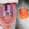 “Het doet verdomt veel pijn”: Kopecky komt met update over blessures na opgave in Tour de l’Ardèche