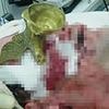Drunk man impales EYE after falling face-first on to ornament - narrowly missing his brain