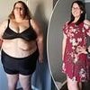 I was too fat to wear shoes. Even Ozempic didn't work and made my hair fall out. But a radical slimming solution helped me shed two thirds of my body weight - and keep it off