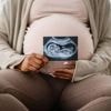 Contrairement aux croyances, les parents n’ont pas autant de chances d’avoir un garçon qu’une fille