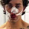 New York model horrifically disfigured after protecting two women from knifeman while vacationing in Germany