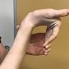 Simple finger flexibility test that reveals risk of terrifying lung disease