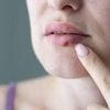 Y a-t-il un lien entre la maladie d’Alzheimer et le virus de l’herpès ? Voici ce que dit la science