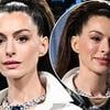 Anne Hathaway continues fueling plastic surgery rumors as fans react to her smooth new face at 2025 Met Gala