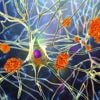 Alzheimer : la Haute Autorité de Santé refuse l'accès précoce au Leqembi, un traitement capable de ralentir légèrement la maladie